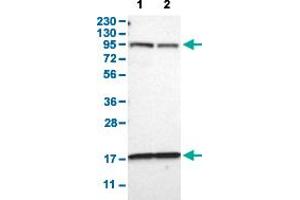 Western Blot analysis with DPP8 polyclonal antibody . (DPP8 抗体  (AA 17-135))