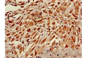 Immunohistochemistry of paraffin-embedded human placenta tissue using ABIN7168188 at dilution of 1:100 (MSK1 抗体  (AA 224-367))