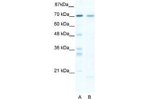 WB Suggested Anti-SOX13 Antibody Titration:  5. (SOX13 抗体  (C-Term))