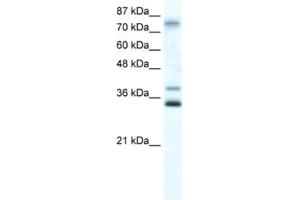 Western Blotting (WB) image for anti-Zinc Finger Protein 570 (ZNF570) antibody (ABIN2461299) (ZNF570 抗体)
