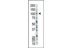Image no. 1 for anti-Ubiquitin Protein Ligase E3A (ube3a) (C-Term) antibody (ABIN357571) (ube3a 抗体  (C-Term))
