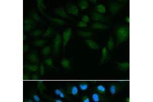 Immunofluorescence analysis of HepG2 cells using EPPIN Polyclonal Antibody (Eppin 抗体)