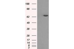 HEK293T cells were transfected with the pCMV6-ENTRY control (Left lane) or pCMV6-ENTRY HDAC10 (Right lane) cDNA for 48 hrs and lysed. (HDAC10 抗体)