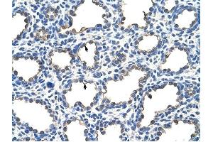 EMP2 antibody was used for immunohistochemistry at a concentration of 4-8 ug/ml to stain Alveolar cells (arrows) in Human Lung. (EMP2 抗体  (Middle Region))