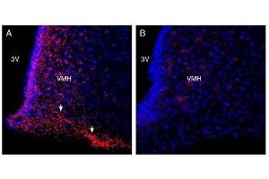 Expression of FFAR4 in rat hypothalamus. (O3FAR1 抗体  (Extracellular))