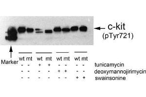 Western blot analysis of extracts from 293T cells(transfected with wild or mutant type c-kit/pc DNA3. (KIT 抗体  (pTyr721))