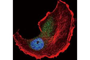 Immunofluorescence (IF) image for anti-Tuberous Sclerosis 2 (TSC2) (pSer1798) antibody (ABIN3001839)