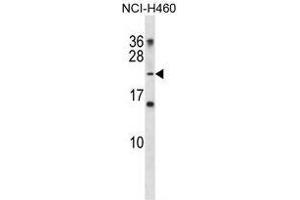 TNNI2 Antibody (N-term) western blot analysis in NCI-H460 cell line lysates (35 µg/lane). (TNNI2 抗体  (N-Term))