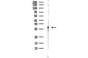 anti-RCAN Family Member 3 (RCAN3) antibody