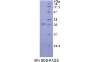 SDS-PAGE analysis of Human ADAM17 Protein. (ADAM17 蛋白)