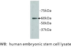 Image no. 1 for anti-Frizzled Family Receptor 5 (FZD5) antibody (ABIN1112891) (FZD5 抗体)