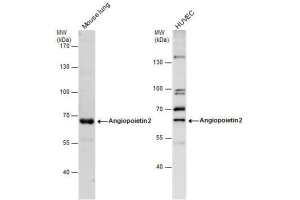 Angiopoietin 2 抗体