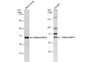 WB Image Angiopoietin 2 antibody detects Angiopoietin 2 protein by western blot analysis.