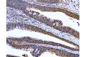IHC analysis of ZMYND8 using anti-ZMYND8 antibody (ABIN7598947).