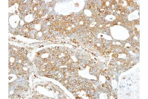 Immunohistochemistry (IHC) image for anti-Fanconi Anemia, Complementation Group C (FANCC) (Center) antibody (ABIN2854743)