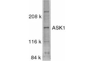 Image no. 1 for anti-Mitogen-Activated Protein Kinase Kinase Kinase 5 (MAP3K5) (C-Term) antibody (ABIN318975) (ASK1 抗体  (C-Term))