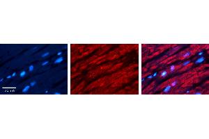 Rabbit Anti-CRY2 Antibody Catalog Number: ARP52398_P050 Formalin Fixed Paraffin Embedded Tissue: Human heart Tissue Observed Staining: Cytoplasmic Primary Antibody Concentration: 1:100 Other Working Concentrations: N/A Secondary Antibody: Donkey anti-Rabbit-Cy3 Secondary Antibody Concentration: 1:200 Magnification: 20X Exposure Time: 0. (CRY2 抗体  (N-Term))