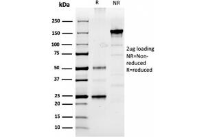 SDS-PAGE Analysis Purified Prolactin Mouse Monoclonal Antibody (PRL/2910). (Prolactin 抗体  (AA 63-201))