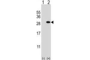 Western Blotting (WB) image for anti-Glutathione S-Transferase theta 1 (GSTT1) antibody (ABIN2997016) (GSTT1 抗体)