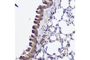 Immunohistochemistry of paraffin-embedded mouse lung using A Rabbit pAb (ABIN7265731) at dilution of 1:100 (40x lens). (ABCA8A 抗体)