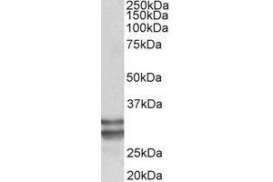 Western Blotting (WB) image for anti-Kruppel-Like Factor 13 (KLF13) (Internal Region) antibody (ABIN2465028) (KLF13 抗体  (Internal Region))