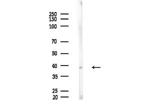 anti-Acyl-CoA Wax Alcohol Acyltransferase 1 (AWAT1) (Internal Region) antibody