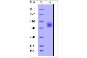 SDS-PAGE (SDS) image for Colony Stimulating Factor 1 (Macrophage) (CSF1) (AA 33-255) (Active) protein (His tag) (ABIN6253718)