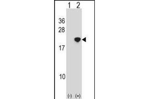 Western blot analysis of NANOS2 (arrow) using rabbit polyclonal NANOS2 Antibody (Center) (ABIN1538503 and ABIN2849951). (NANOS2 抗体  (AA 58-85))