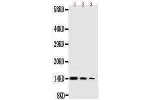 Anti-human NGF antibody, Western blotting Lane 1: Recombinant Human NGFB Protein 10ng Lane 2: Recombinant Human NGFB Protein 5ng Lane 3: Recombinant Human NGFB Protein 2 (Nerve Growth Factor 抗体  (AA 122-241))