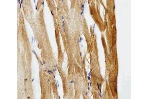 IHC analysis of FFPE zebrafish muscle section using Gfap antibody; Ab was diluted at 1:25.