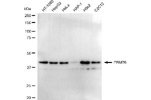 Western blotting analysis using PRMT6 antibody (ABIN7799972). (Recombinant PRMT6 抗体)