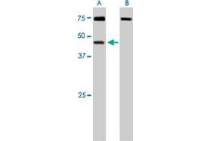 DYX1C1 polyclonal antibody  staining (0. (DYX1C1 抗体)