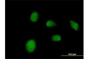 Immunofluorescence of purified MaxPab antibody to NANP on HeLa cell. (NANP 抗体  (AA 1-248))