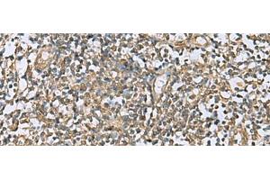 Immunohistochemistry of paraffin-embedded Human tonsil tissue using LFNG Polyclonal Antibody at dilution of 1:60(x200) (LFNG 抗体)
