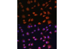 Immunofluorescence analysis of L929 cells using RPS19BP1 antibody (ABIN6132999, ABIN6147207, ABIN6147208 and ABIN6217154) at dilution of 1:100. (RPS19BP1 抗体  (AA 1-136))