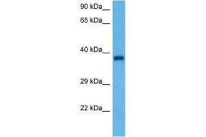 Host:  Rabbit  Target Name:  GAPDH  Sample Tissue:  Rat Brain  Antibody Dilution:  1ug/ml (GAPDH 抗体  (Middle Region))