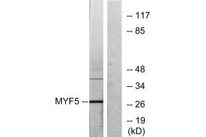 Western blot analysis of extracts from HepG2 cells, using MYF5 antibody. (MYF5 抗体  (Internal Region))