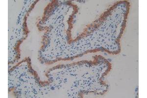 DAB staining on IHC-P; Samples: Mouse Vas Deferens Tissue (CD109 抗体  (AA 890-1131))