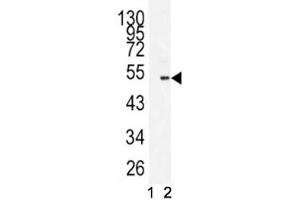Western blot analysis of BMI1 antibody antibody and 293 lysate in the presence (1) and absence (2) of immunizing peptide. (BMI1 抗体  (AA 257-286))