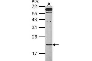 WB Image Sample (30 ug of whole cell lysate) A: Raji 12% SDS PAGE antibody diluted at 1:1000 (TMED2 抗体  (Center))