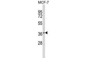 Western blot analysis of BMI1 Antibody in MDA-MB231 cell line lysates (35ug/lane). (BMI1 抗体)