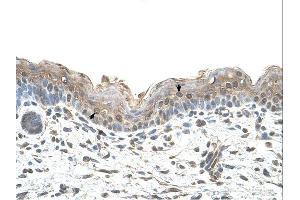 Ribophorin II antibody was used for immunohistochemistry at a concentration of 4-8 ug/ml. (Ribophorin II 抗体  (N-Term))