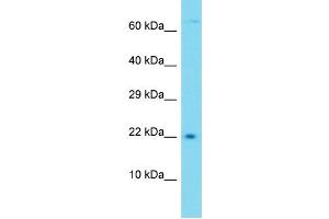 Western Blotting (WB) image for anti-Transmembrane Protein 52B (TMEM52B) (C-Term) antibody (ABIN2791294) (TMEM52B 抗体  (C-Term))