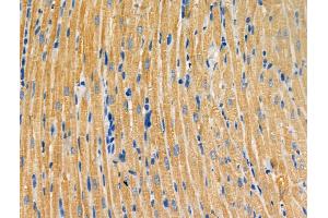 ABIN6259898 and ABIN6266940 at 1/100 staining Rat heart tissue by IHC-P. (ALPK2 抗体  (Internal Region))