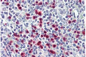 Human Spleen (formalin-fixed, paraffin-embedded) stained with S100A8 antibody ABIN364230 at 1:50 followed by biotinylated anti-mouse IgG secondary antibody ABIN481714, alkaline phosphatase-streptavidin and chromogen. (S100A8 抗体  (FITC))