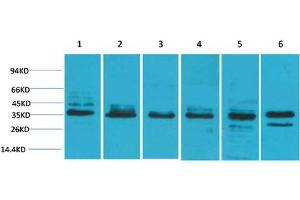 Western Blot (WB) analysis of 1) HeLa, 2) 293T, 3) C2C12, 4) Mouse Liver Tissue, 5) PC12, 6) Rat Brain Tissue with TBP Rabbit Polyclonal Antibody diluted at 1:2000. (TBP 抗体)