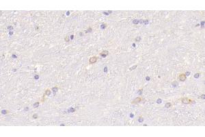Immunohistochemistry (IHC) image for anti-Wingless-Type MMTV Integration Site Family, Member 5A (WNT5A) (AA 62-380) antibody (ABIN7430201)