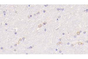 Detection of WNT5A in Mouse Cerebrum Tissue using Polyclonal Antibody to Wingless Type MMTV Integration Site Family, Member 5A (WNT5A) (WNT5A 抗体  (AA 62-380))