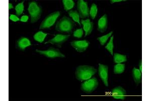 Immunofluorescence of monoclonal antibody to TXN on HeLa cell. (TXN 抗体  (AA 1-105))