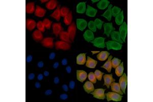 ABIN6262772 and ABIN6267008 staining Hela cells(45 min of heat-shock treatment) by IF/ICC. (KRT15 抗体)